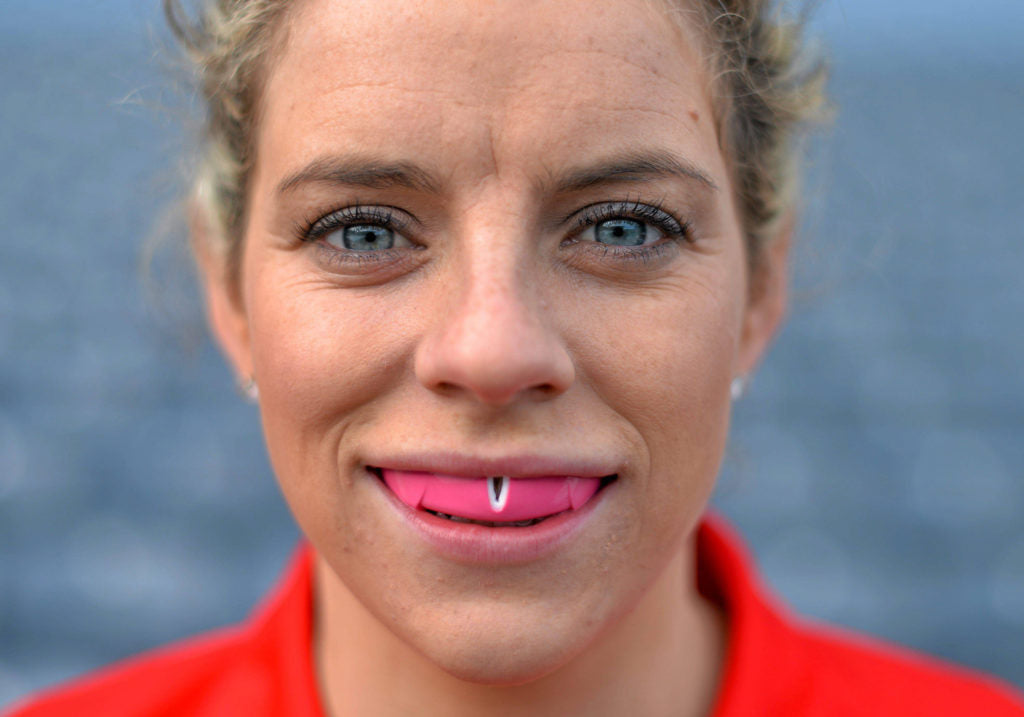 Mouthguards